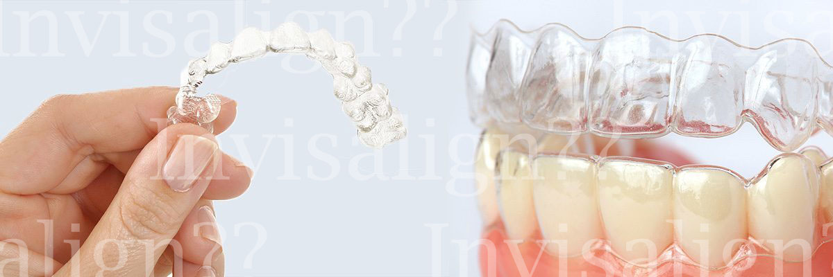 Mountain View Does Invisalign® Really Work?